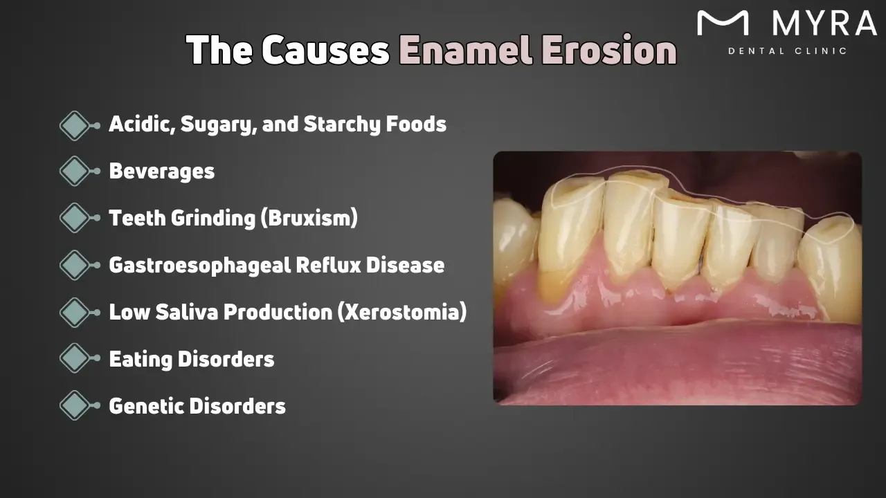 What are the causes of enamel erosion?