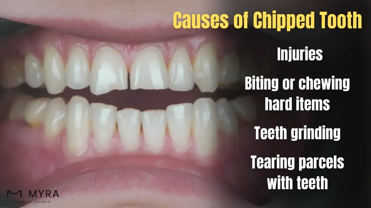 What are the causes of a chipped tooth in turkey?