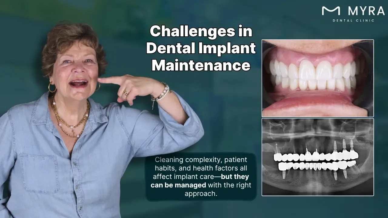what are the challenges of dental implant maintenance?