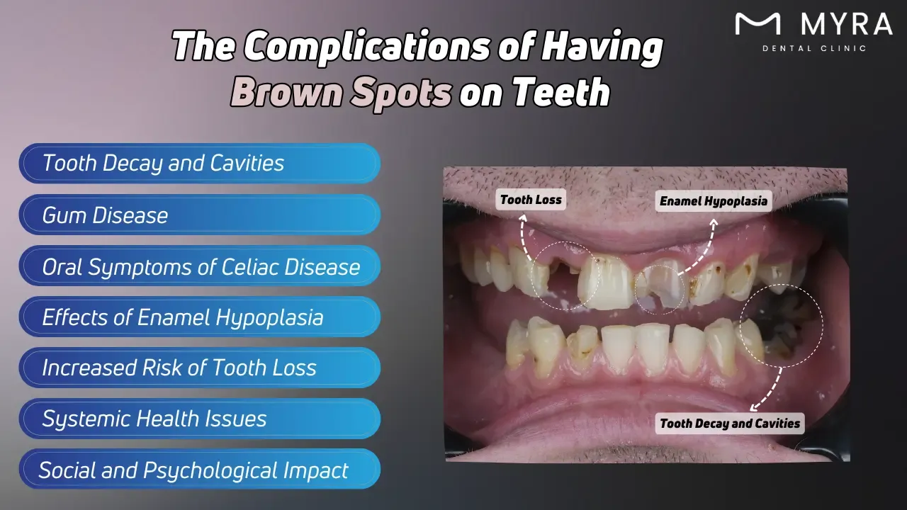 What are the complications of having brown spots on teeth?