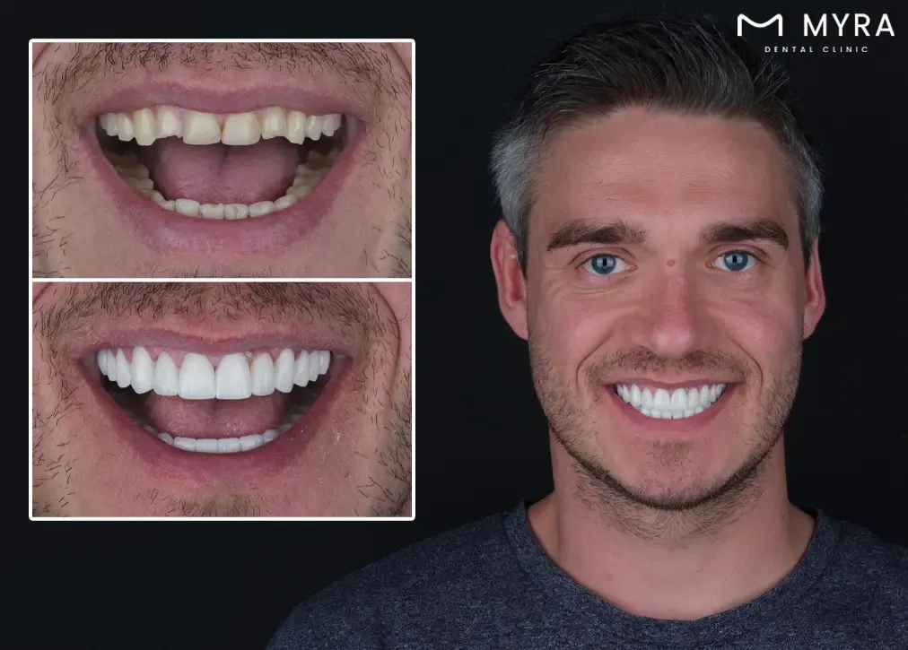 what are the dental treatment options in turkey?