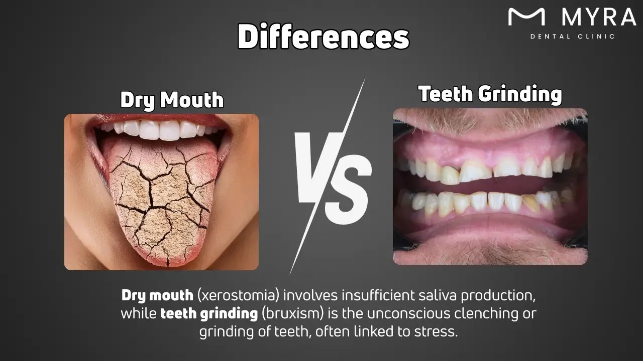 What is the difference between dry mouth and teeth grinding?