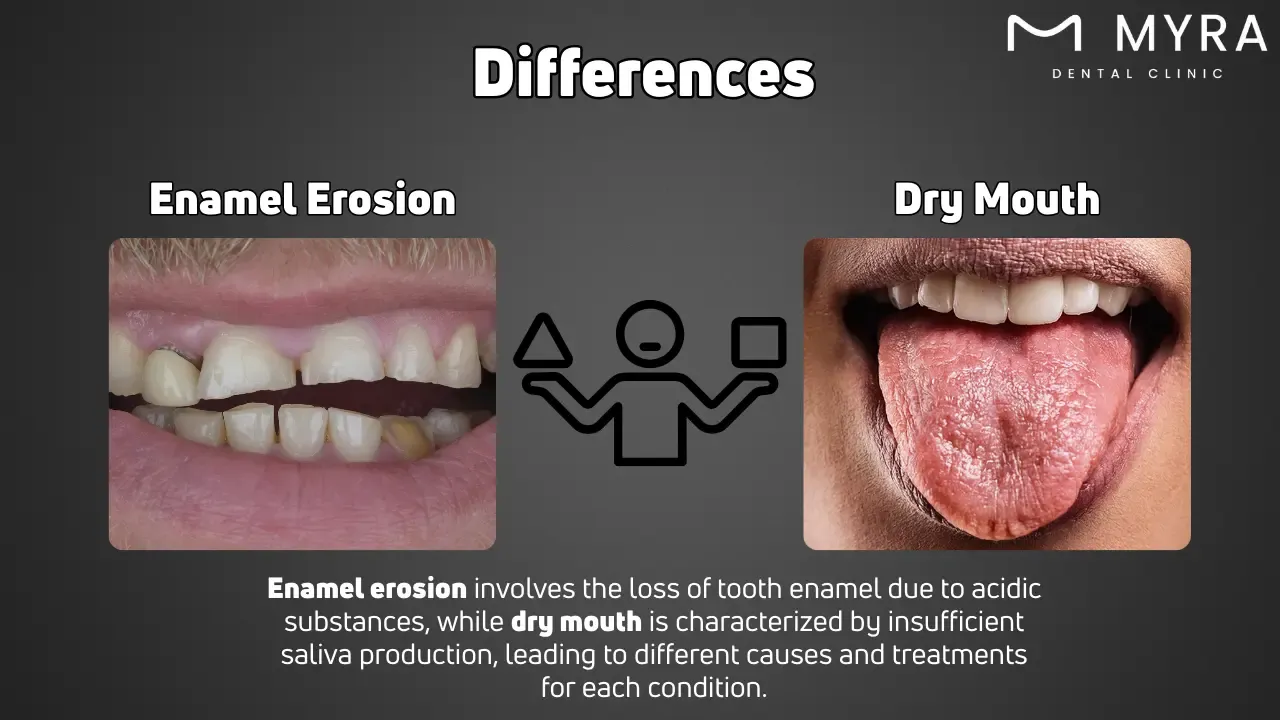 What are the differences between enamel erosion and dry mouth?