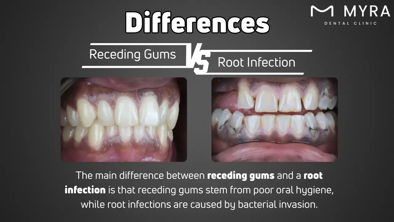 What is the difference between receding gums and a root infection?