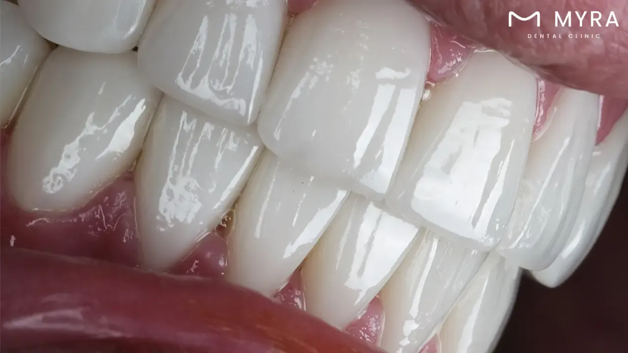 What is the difference between a cavity and a toothache?