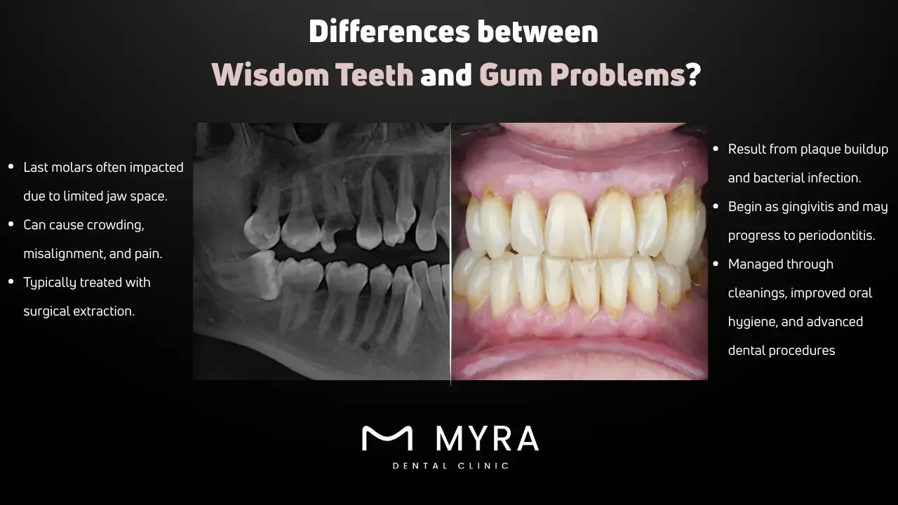 What is the difference between wisdom teeth problems and gum problems?