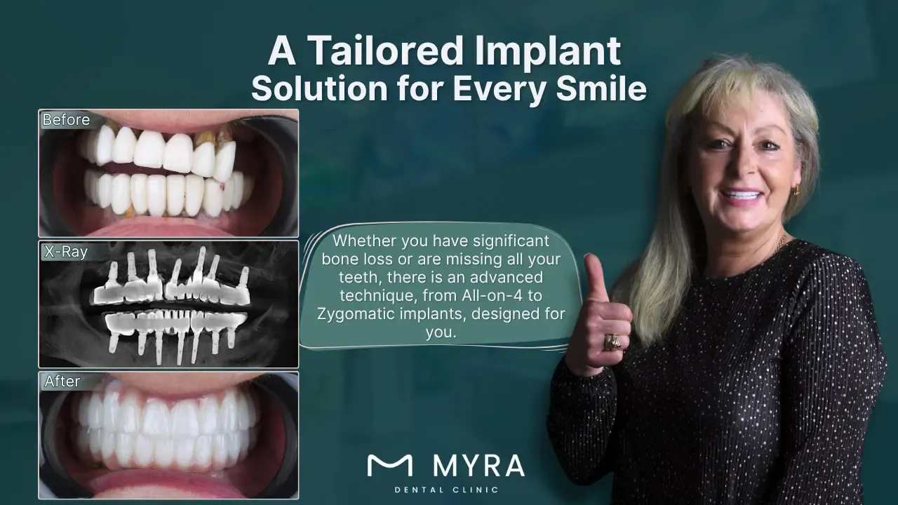 what are the different dental implant techniques