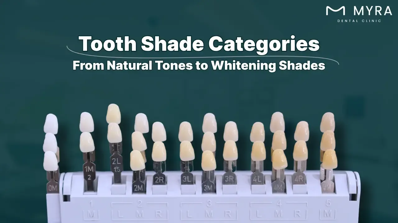 what are the different tooth shade categories?