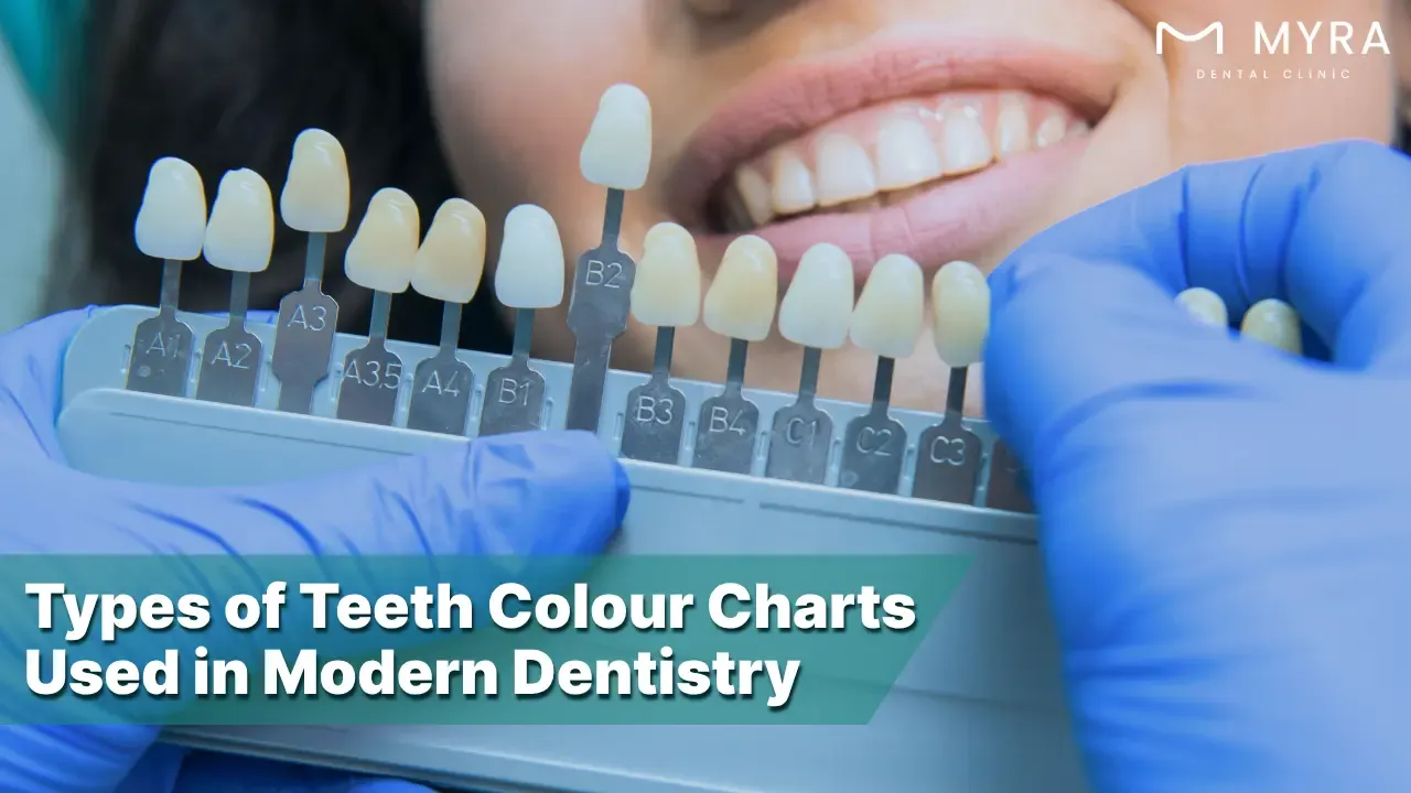 what are the different types of teeth colour charts?