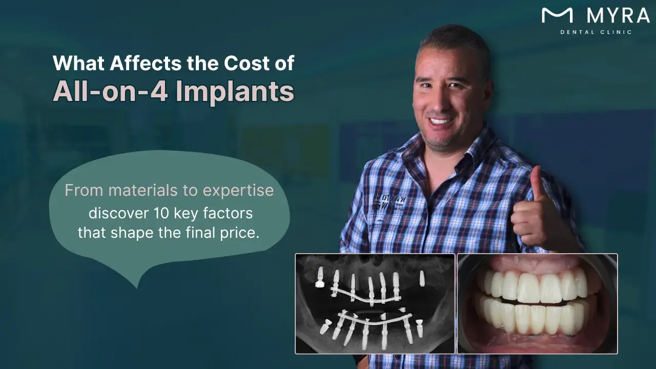 what are the factors affecting the cost of all-on-4 implants?