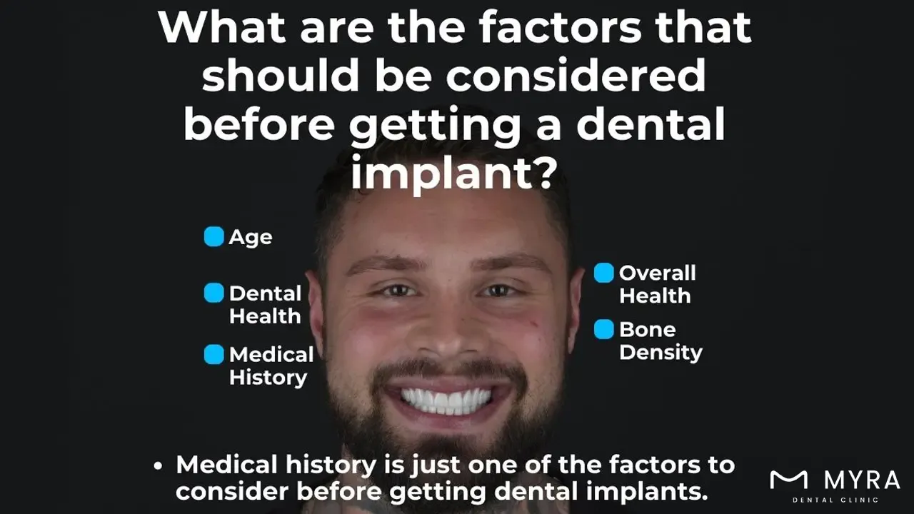 what are the factors that should be considered before getting a dental implant?
