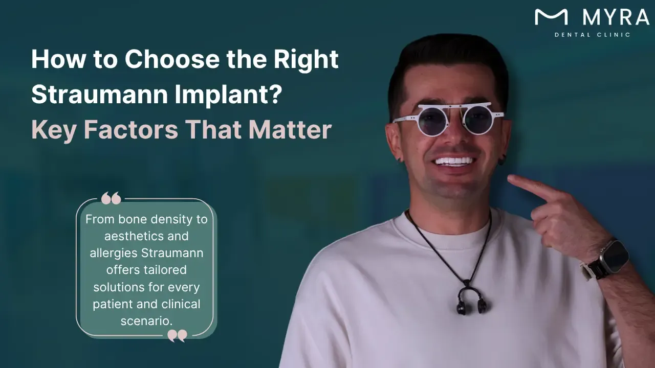 what-are-the-factors-to-consider-when-choosing-a-straumann-implant.webp