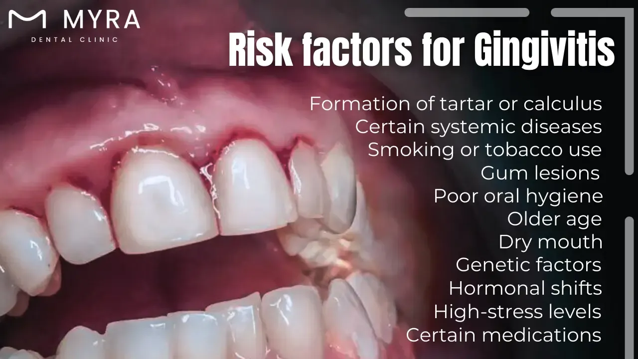 What are the risk factors for gingivitis in turkey?