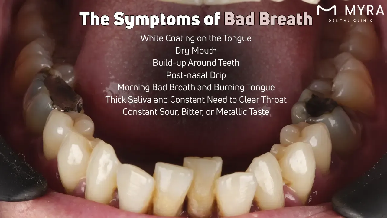 What are the symptoms of bad breath?