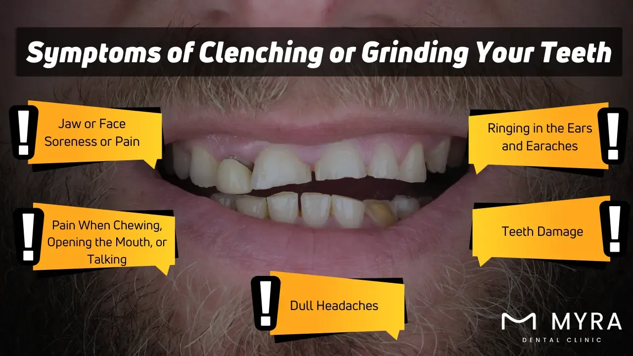 What are the symptoms of clenching or grinding your teeth?