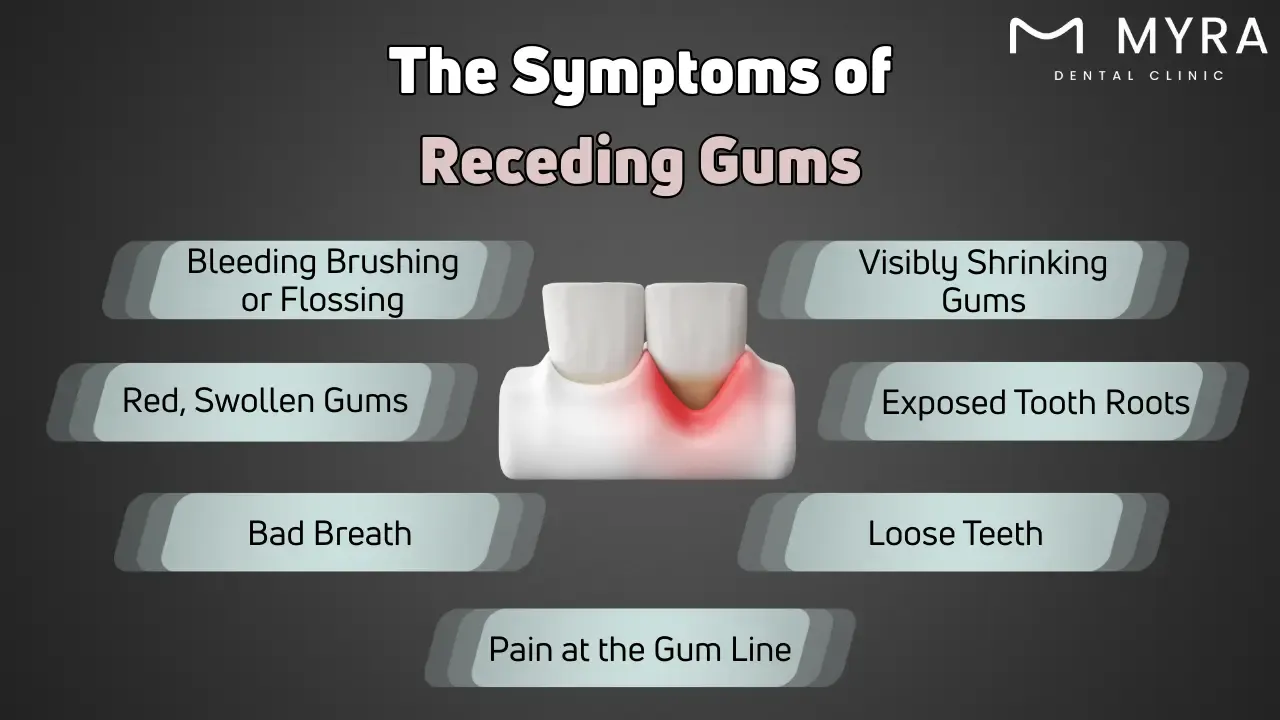What are the symptoms of receding gums?