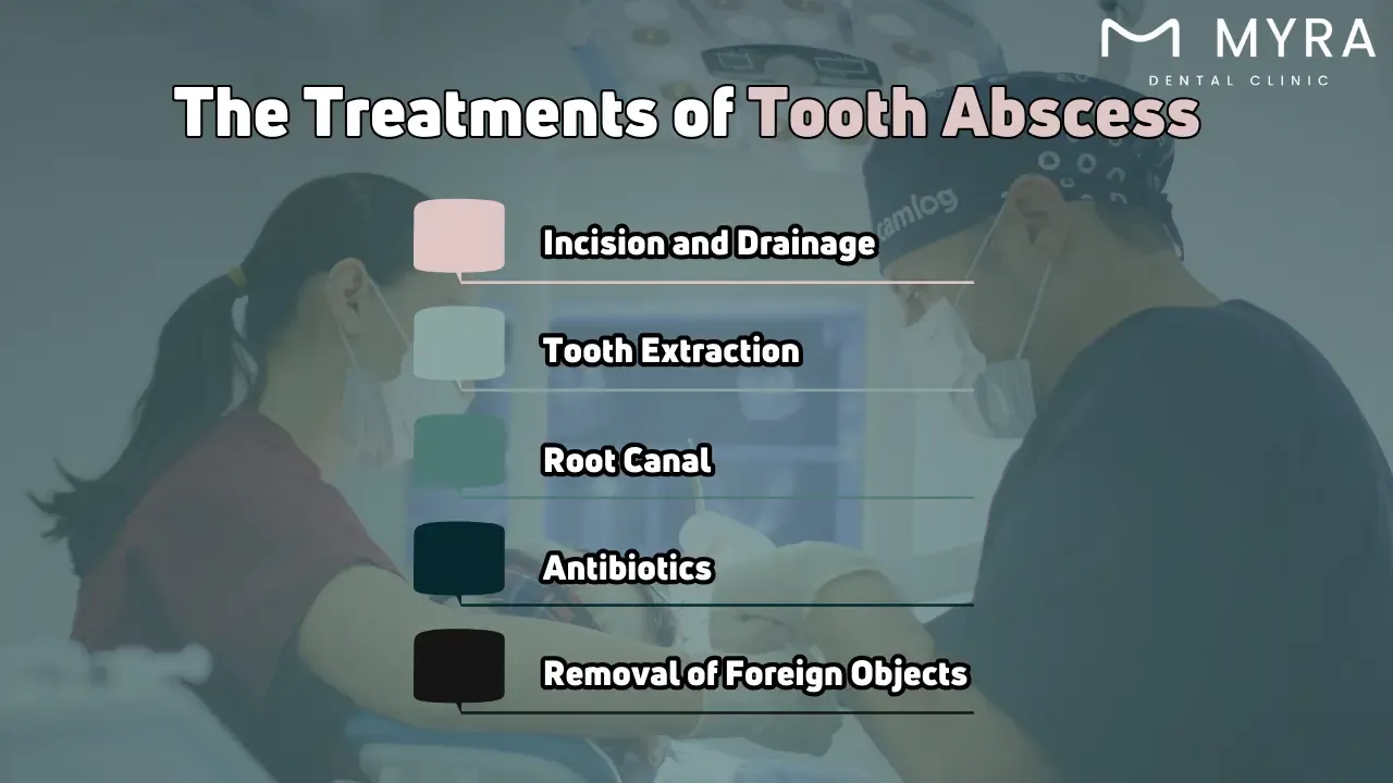What is the treatment for a tooth abscess?