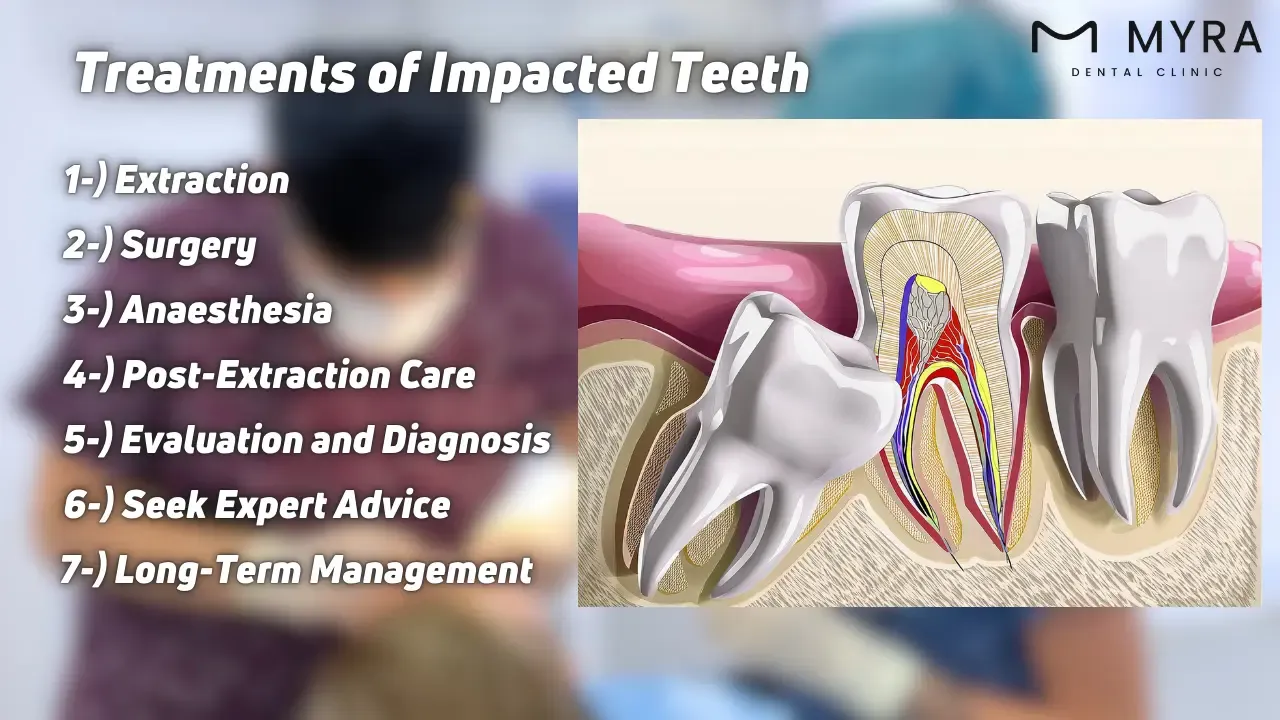 What are the treatments for impacted teeth?