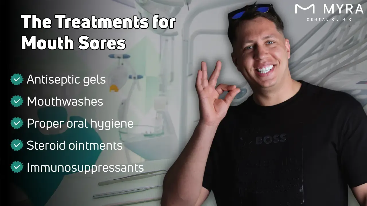 What are the treatments for mouth sores?