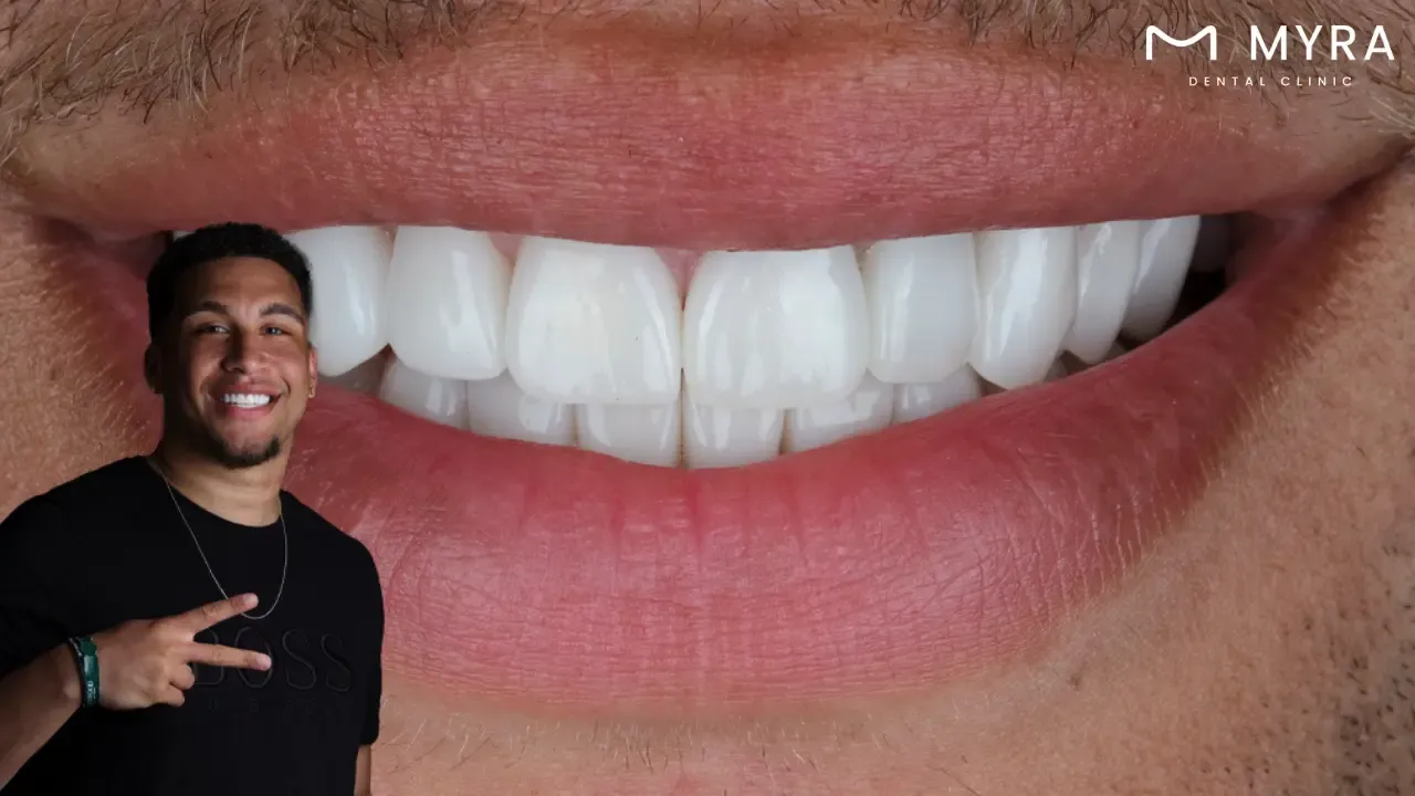 What are the treatments for cavities?