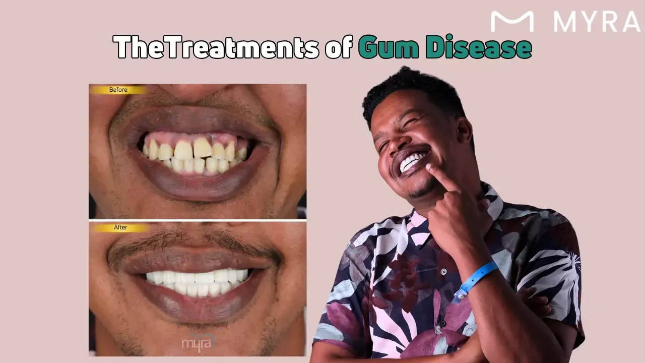 What are the treatments for gum disease?