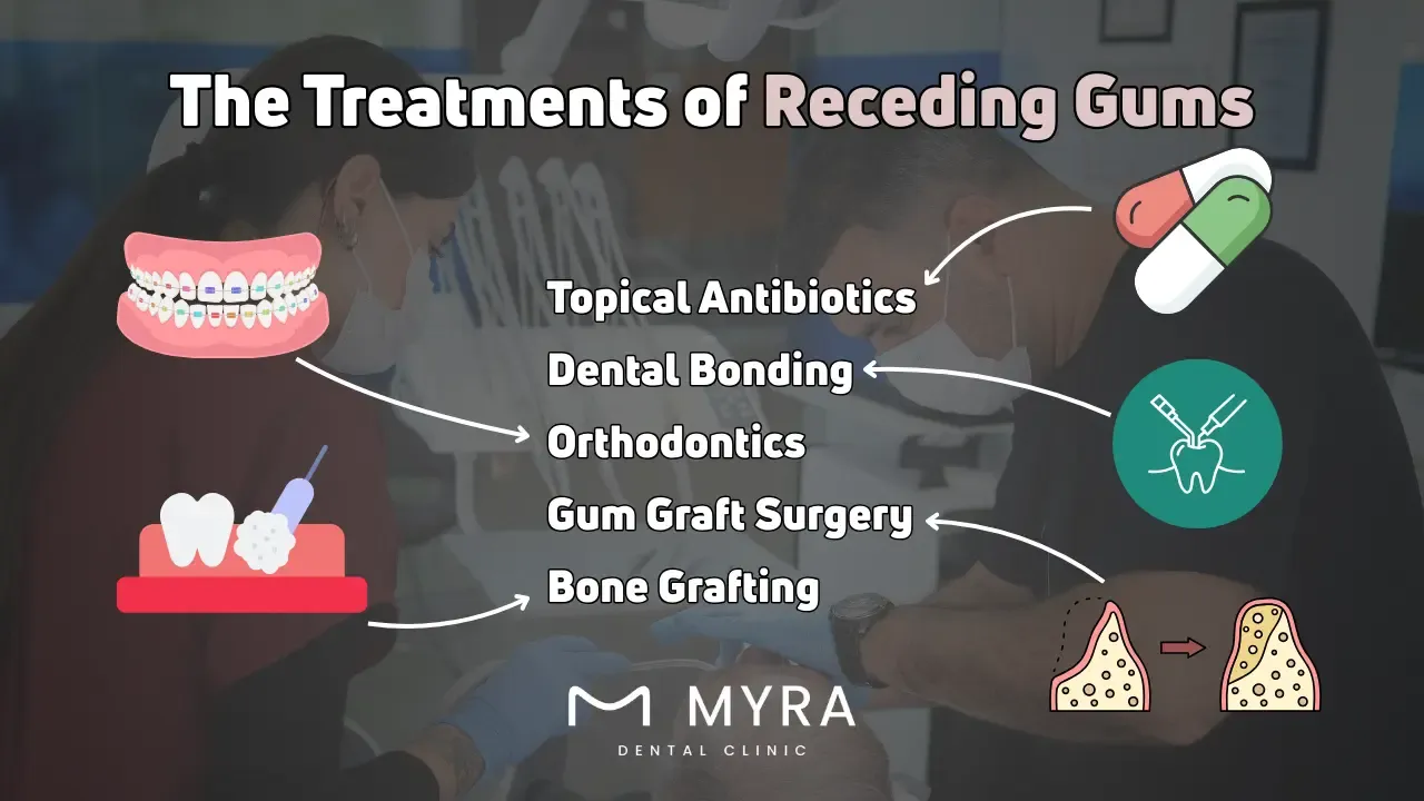 What are the treatments for receding gums?