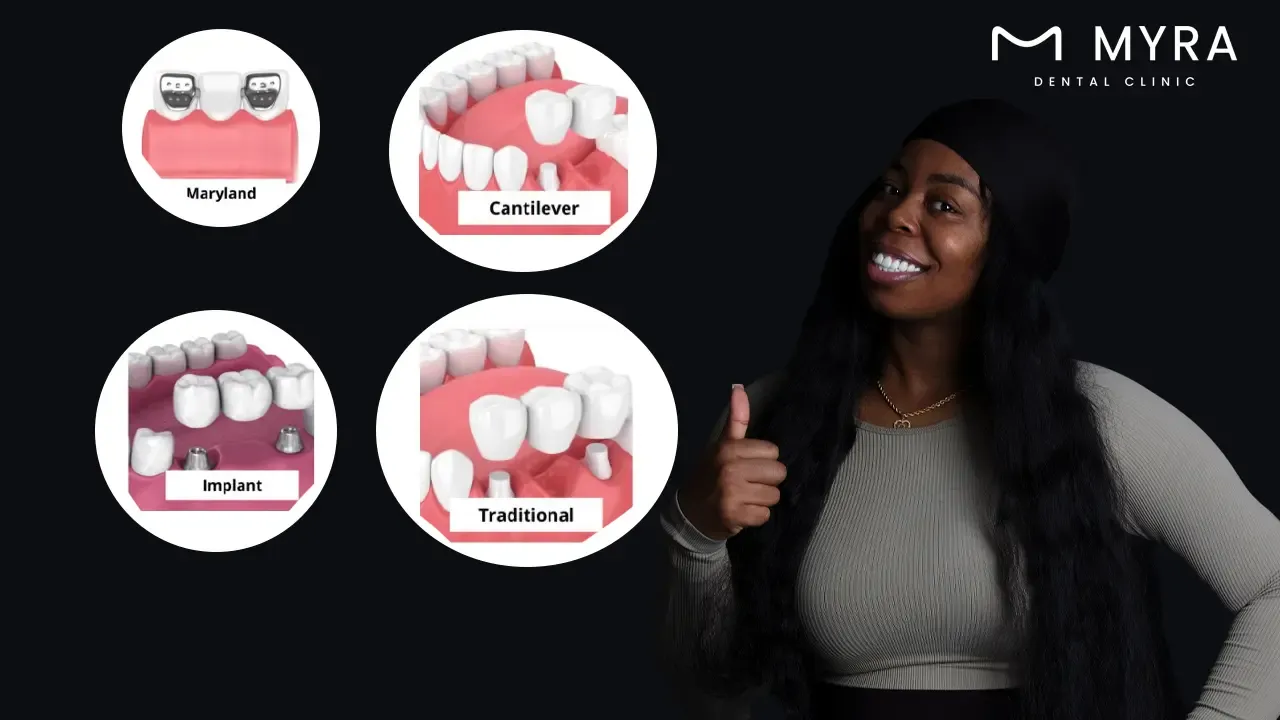 what are the types of dental bridges?