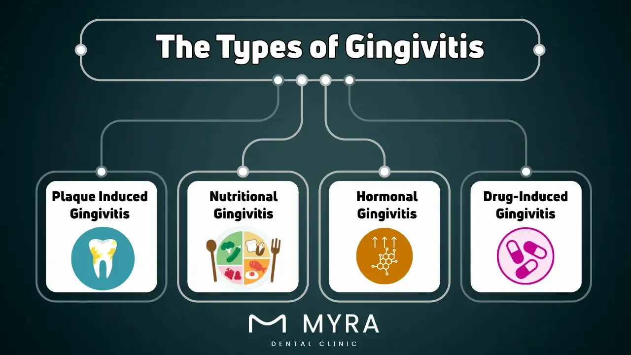 What are the types of gingivitis?