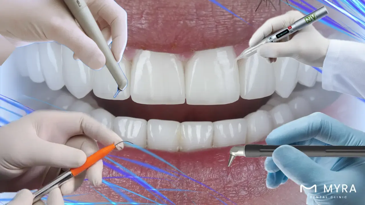 What are the types of lasers used in dentistry in turkey?