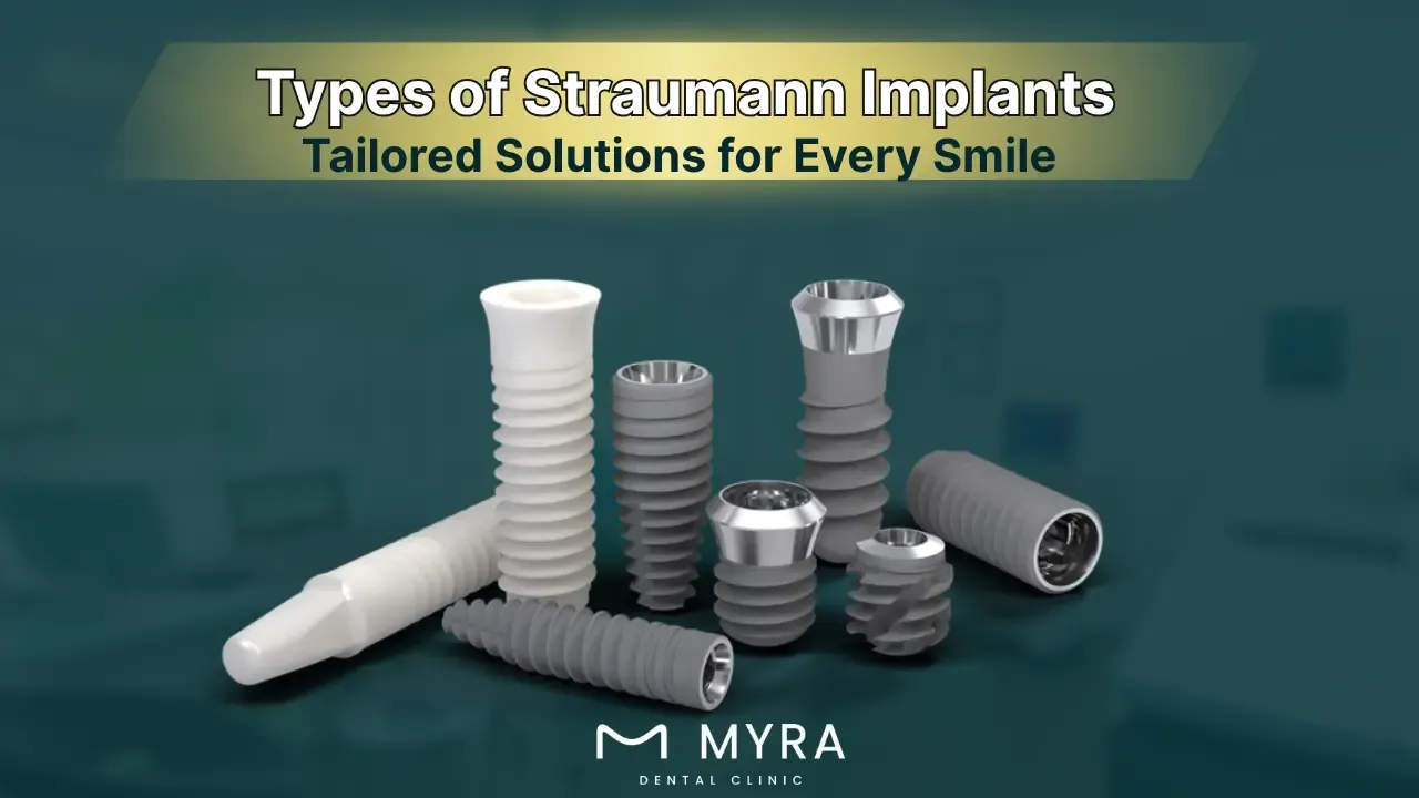 what-are-the-types-of-straumann-implants.webp