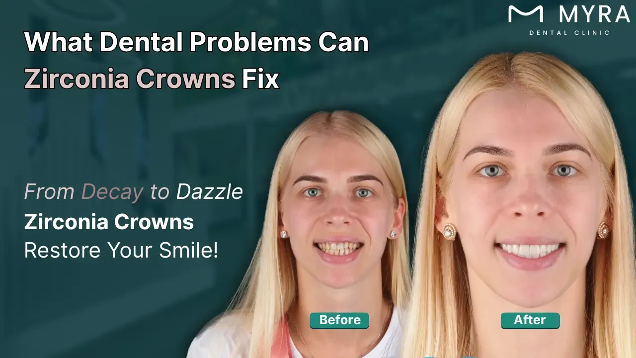 what common dental problems can be fixed by zirconia crowns?