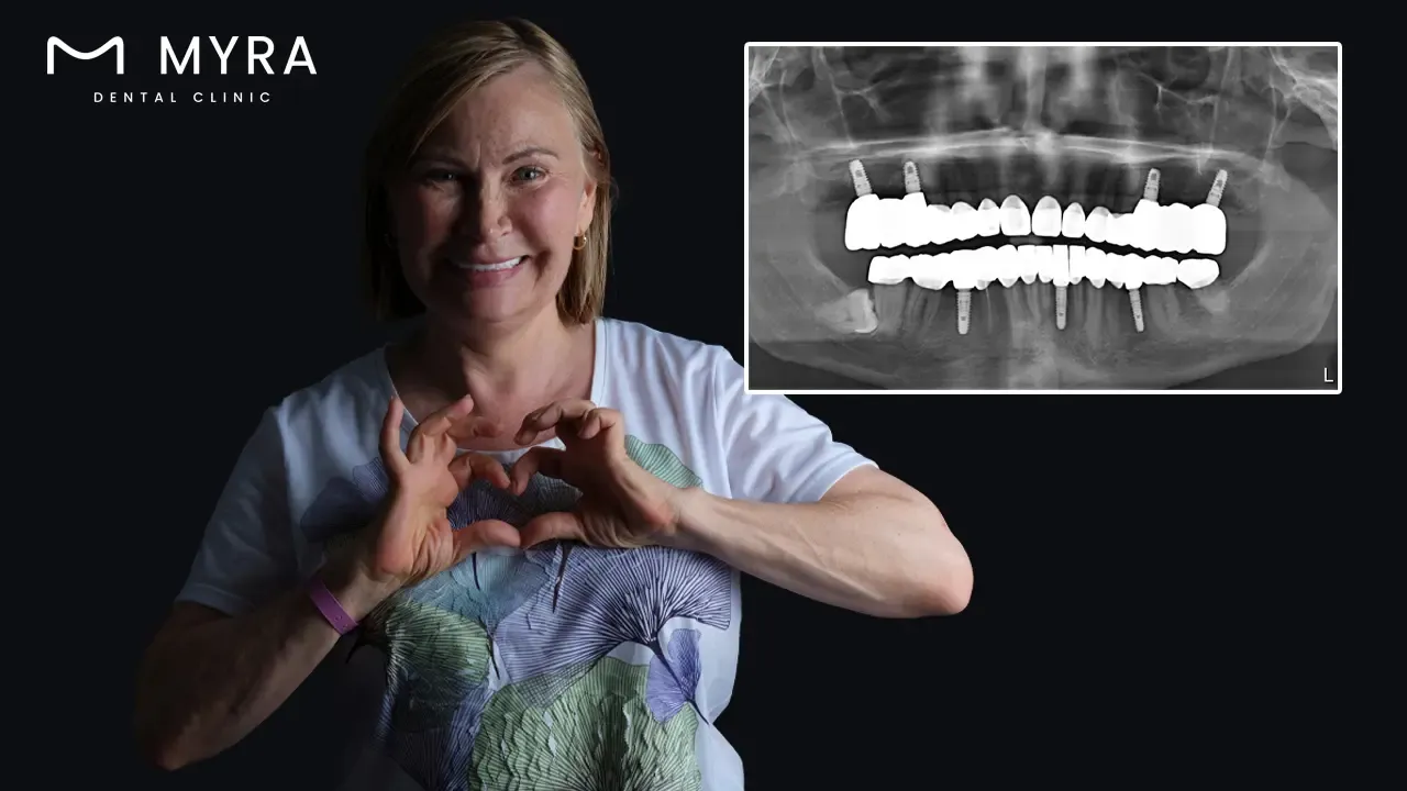 what is a dental bridge?