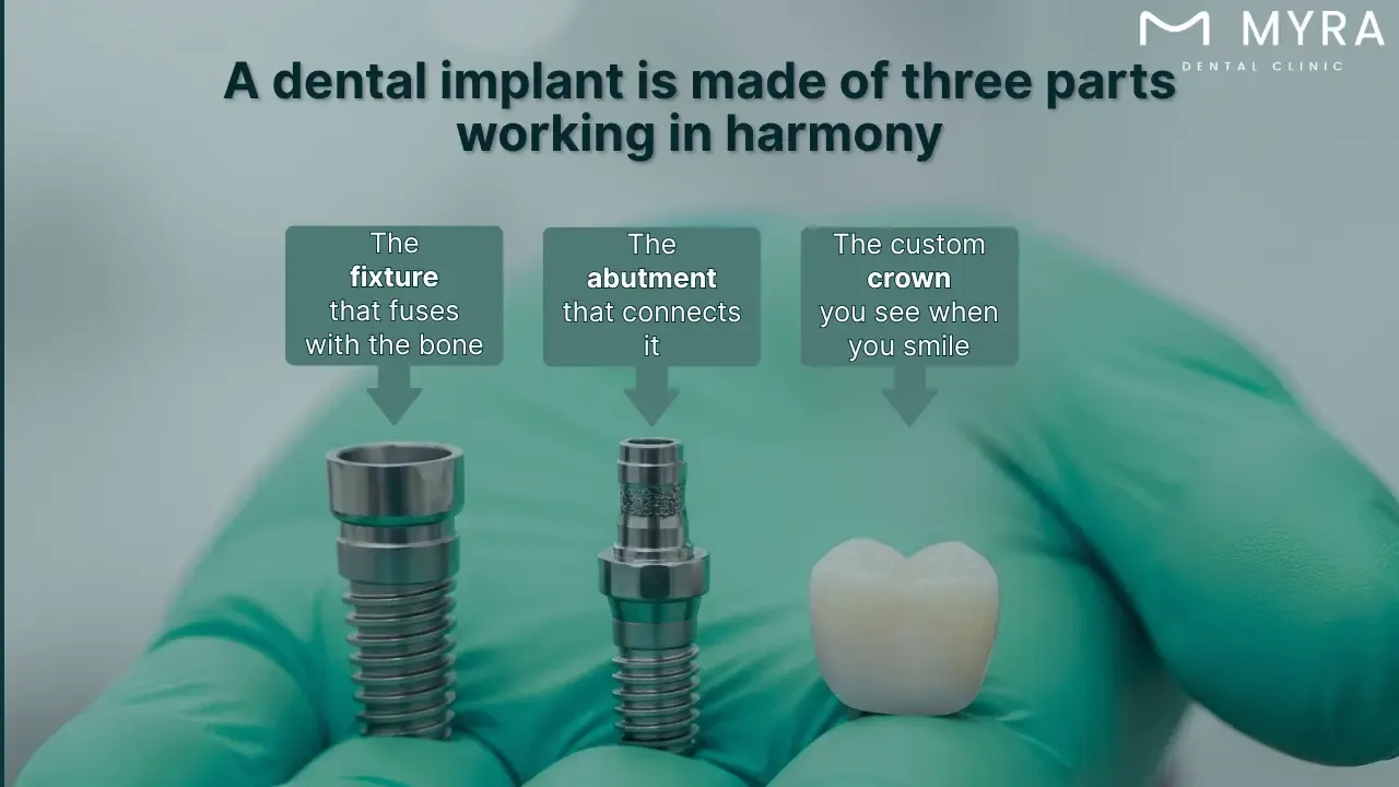 what is a dental implant?