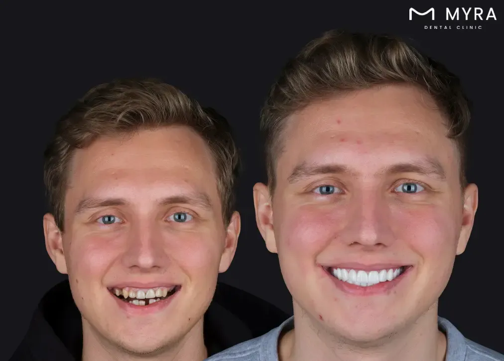 what is cosmetic dentistry in turkey?