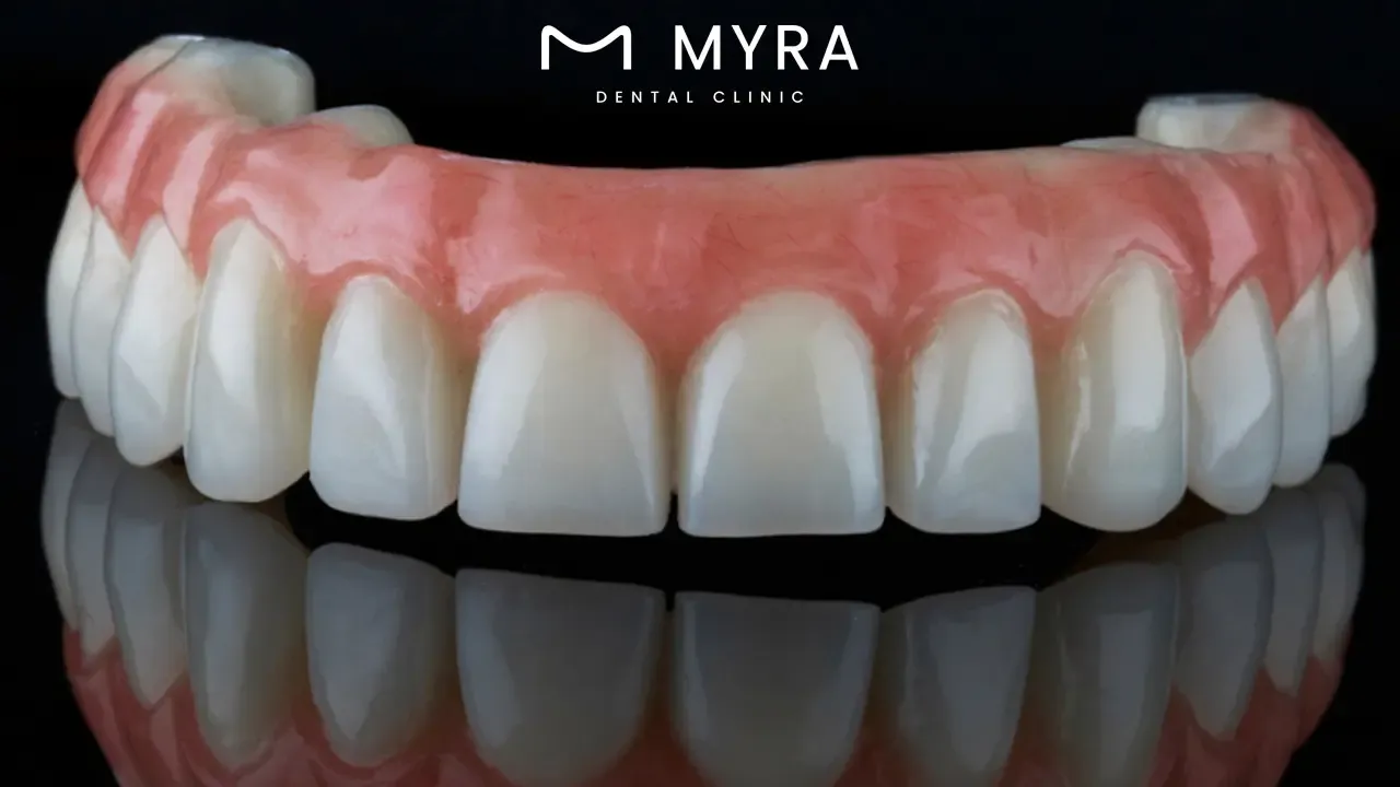 What is a denture?