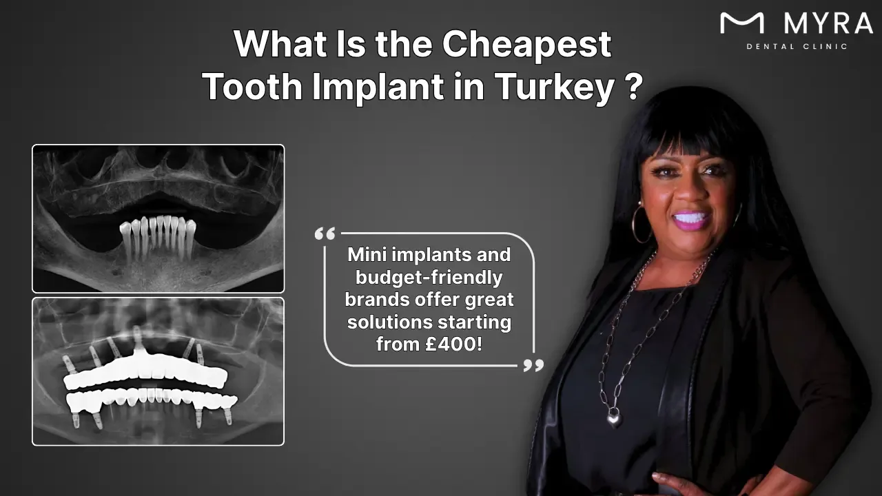 what-is-the-cheapest-tooth-implant-in-turkey.webp