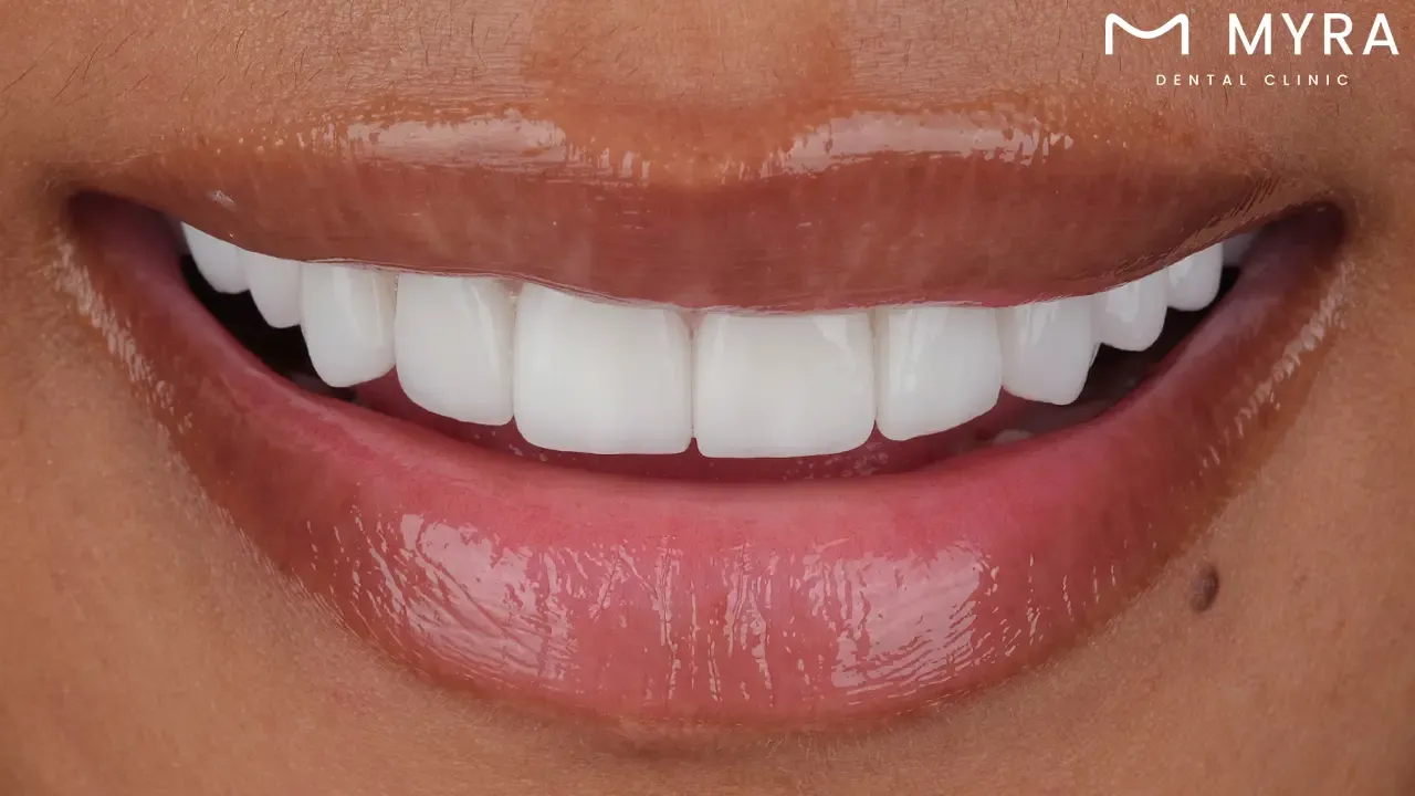 what is the main purpose of autograft tissue?