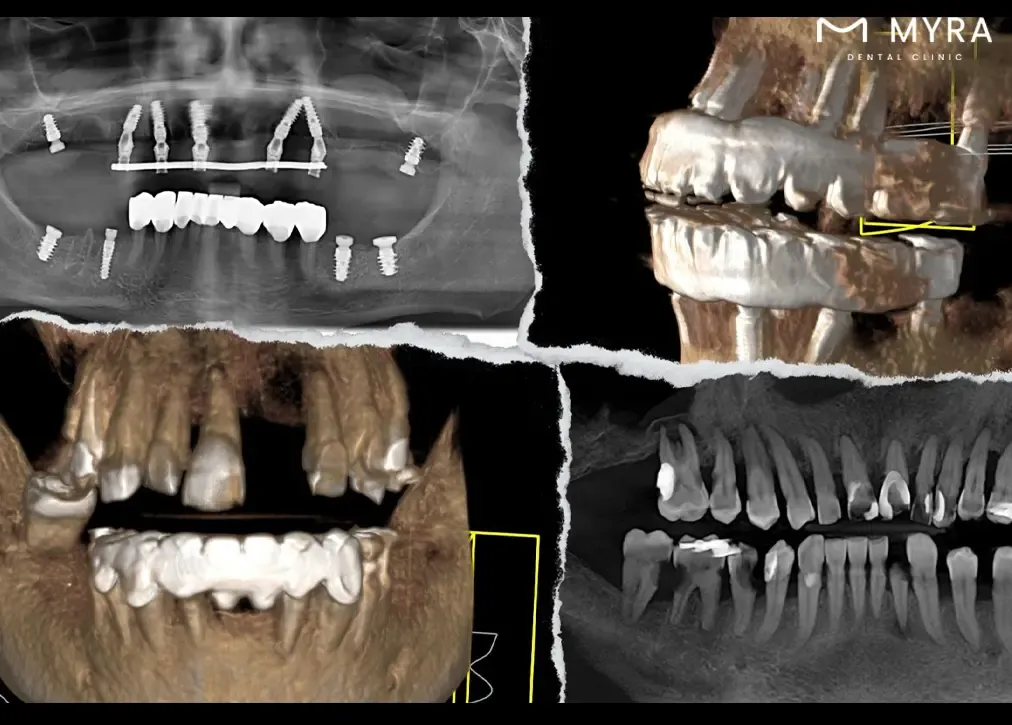 What is the role of sirona 3d dental tomography in dental practices?