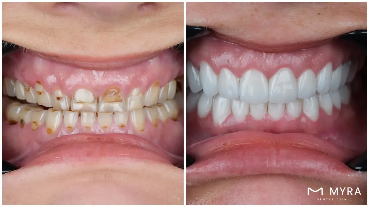 what kinds of services do general dentists provide?