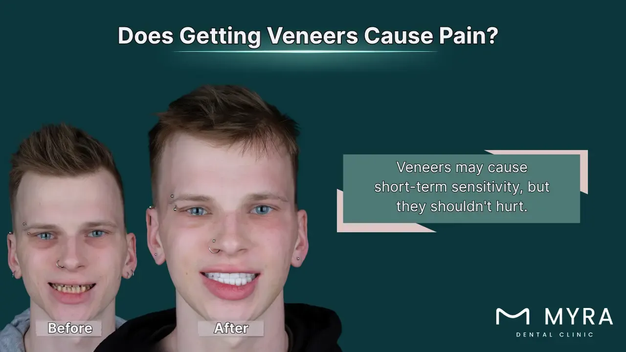 What types of pain can you feel after a dental veneer procedure?