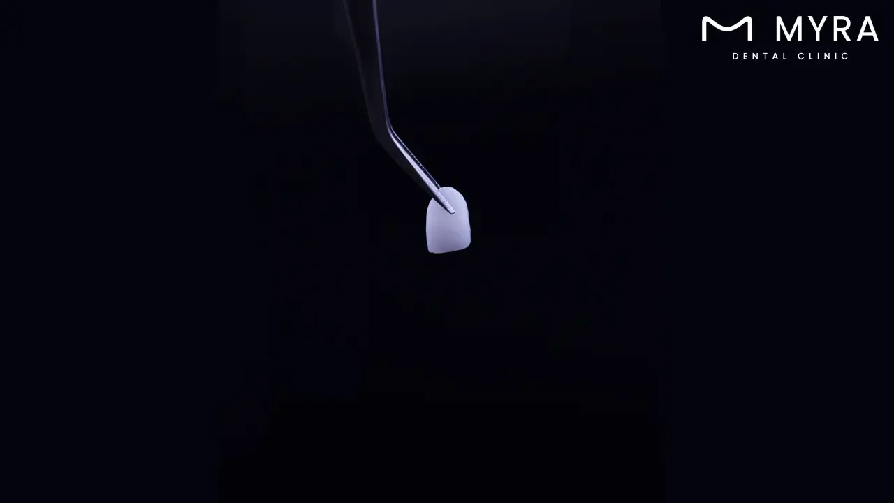  What types of veneer materials are available in the uk and turkey