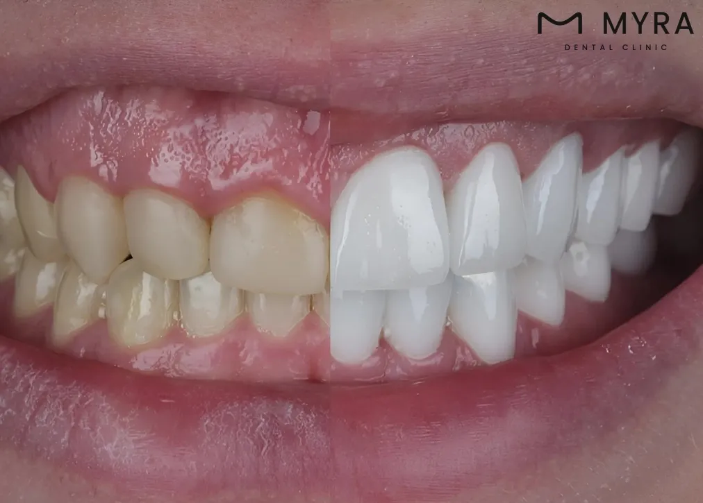 which country generally offers more cost-effective dental treatments: mexico or turkey?