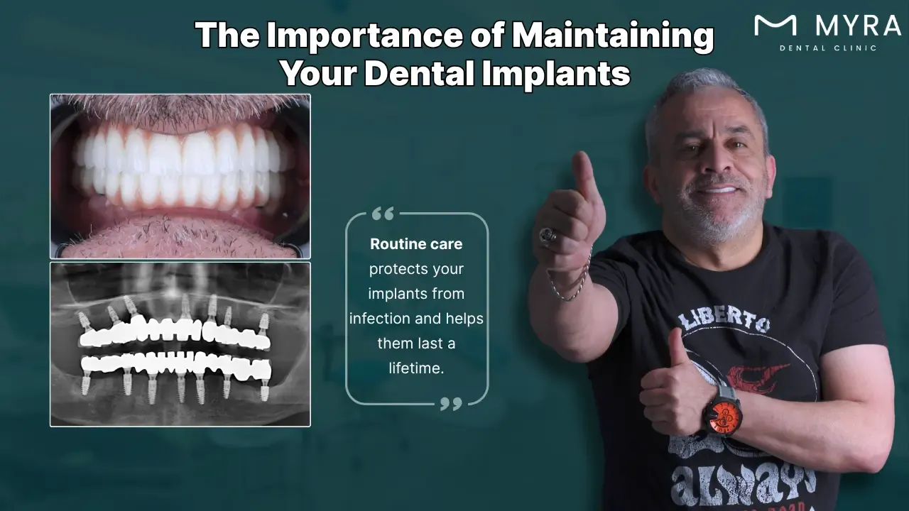 why dental implant maintenance is important