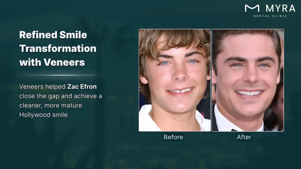 zac efron's smile glow-up