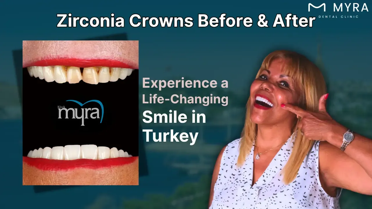 zirconia crown before and after pictures