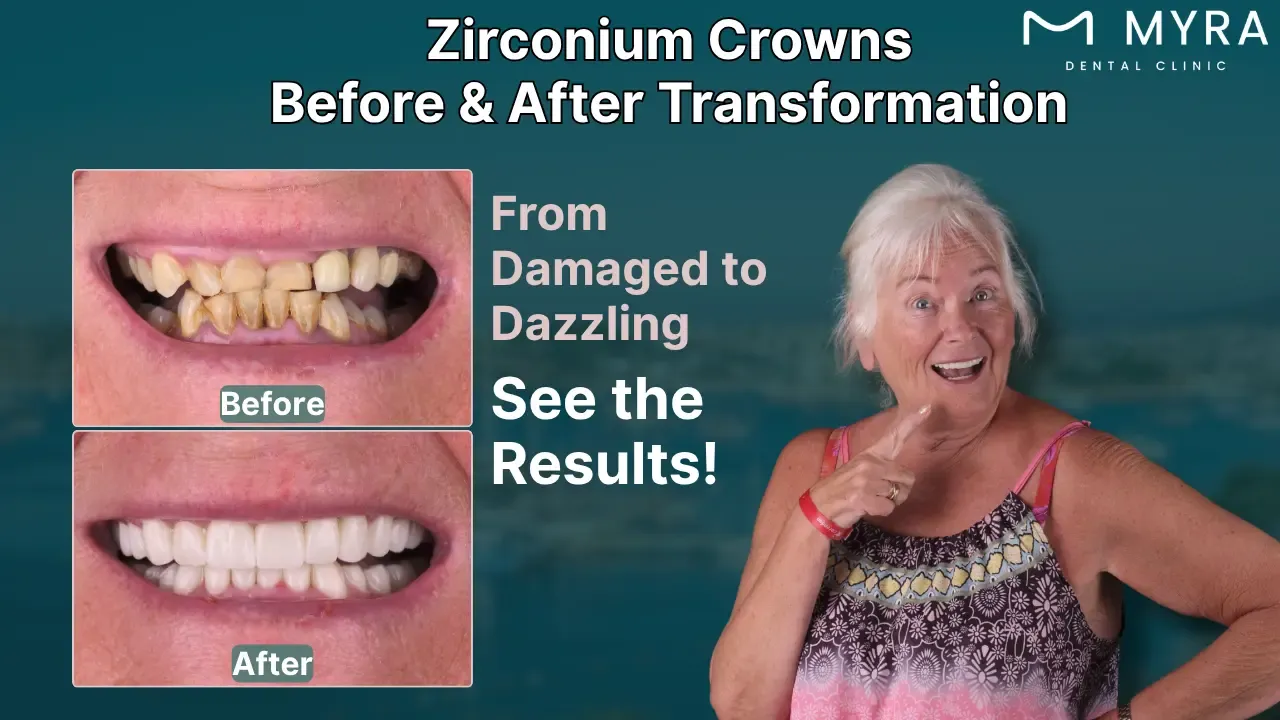 zirconium crowns before and after