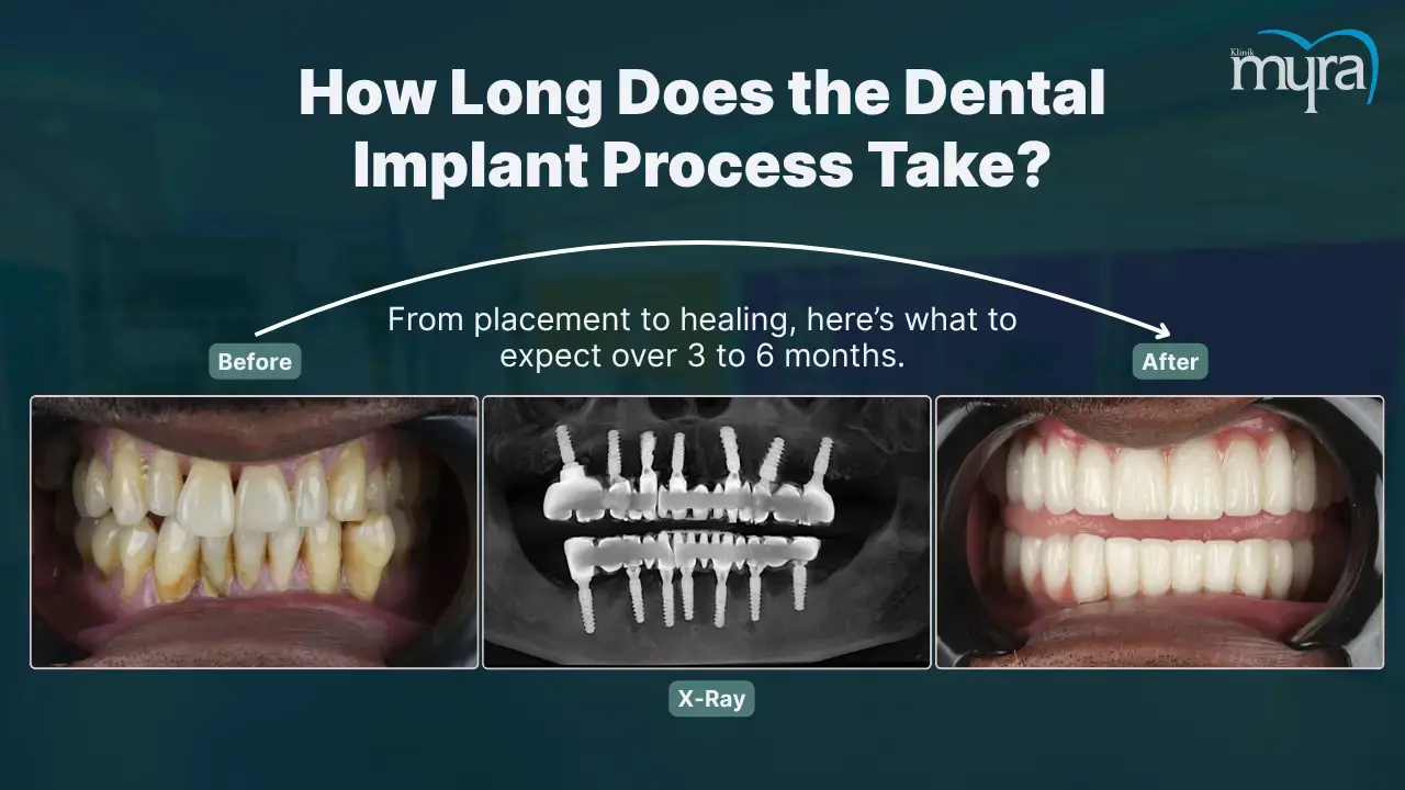 5-the-process-includes-several-stages-over-multiple-months