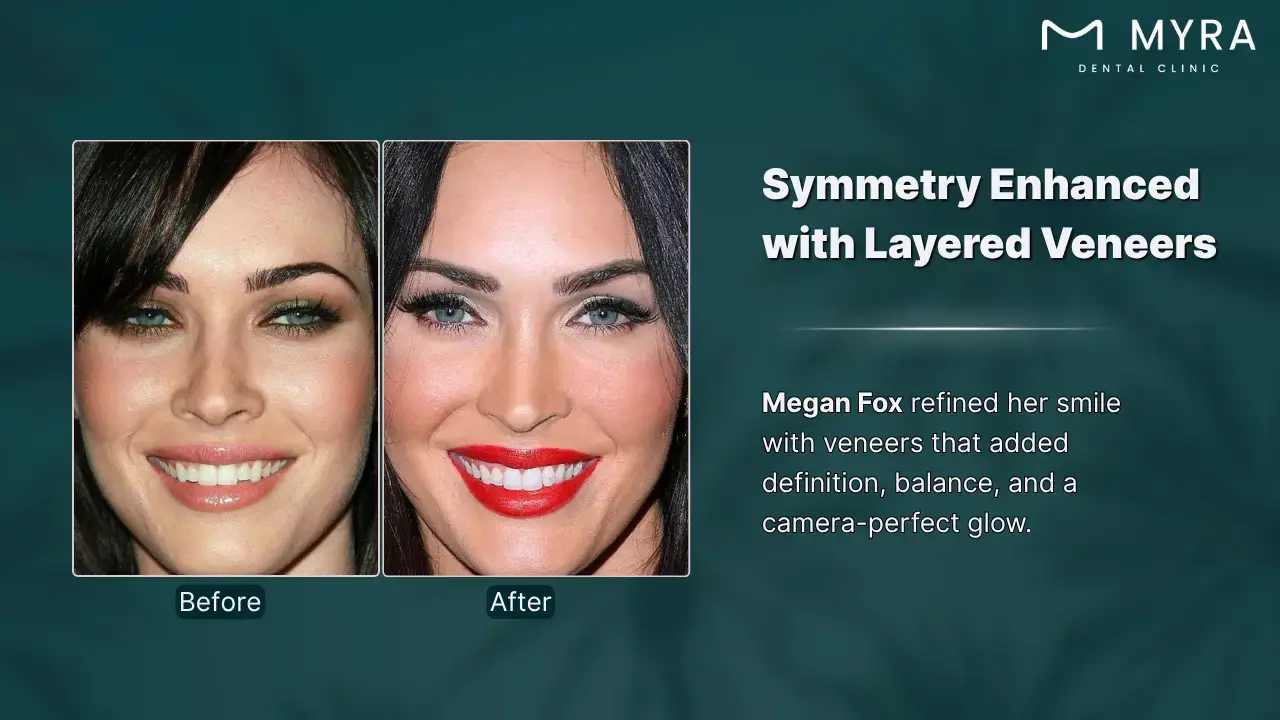 25-megan-fox