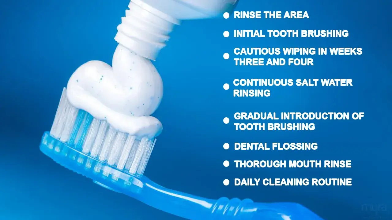 how-to-maintain-custom-made-abutments
