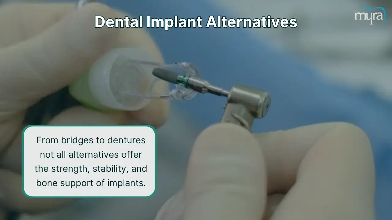 what-are-the-alternatives-to-dental-implant